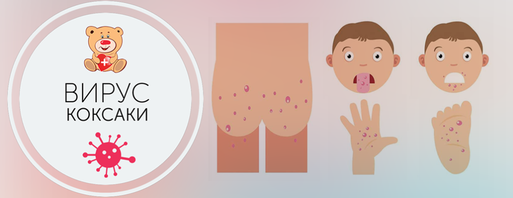 Санпросвет